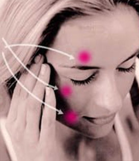 nevralgie du trijumeau